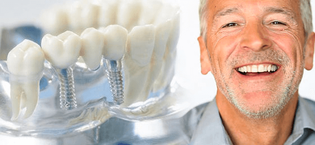 Протезирование зубов 